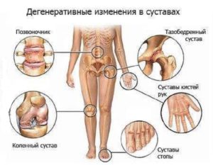 суставы рук и ног анатомия